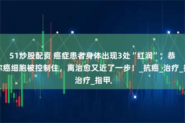 51炒股配资 癌症患者身体出现3处“红润”，恭喜你癌细胞被控制住，离治愈又近了一步！_抗癌_治疗_指甲
